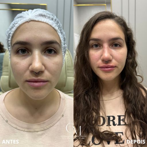 Full-Face-10