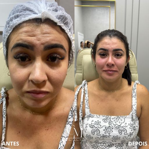 Full-Face-11