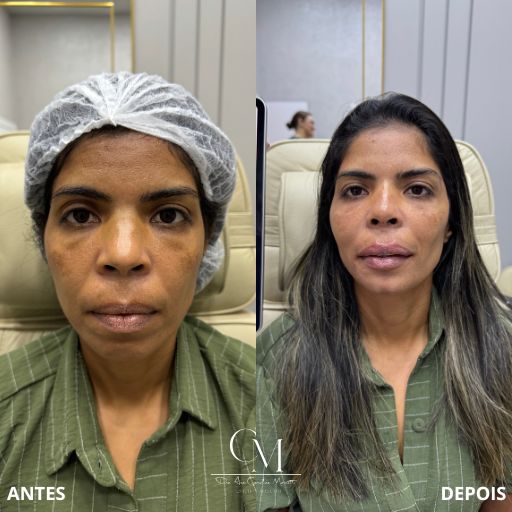 Full-Face-12