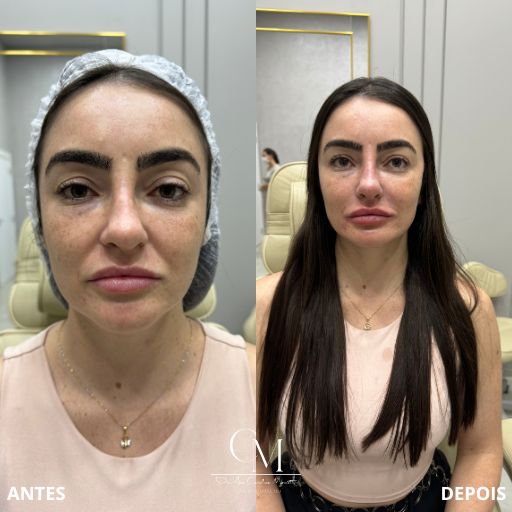 Full-Face-2