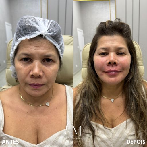 Full-Face-4