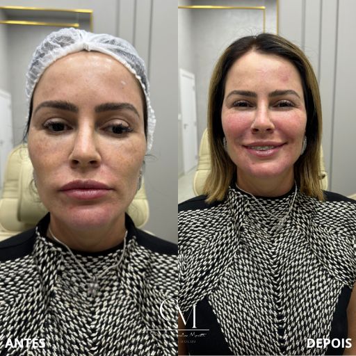 Full-Face-8