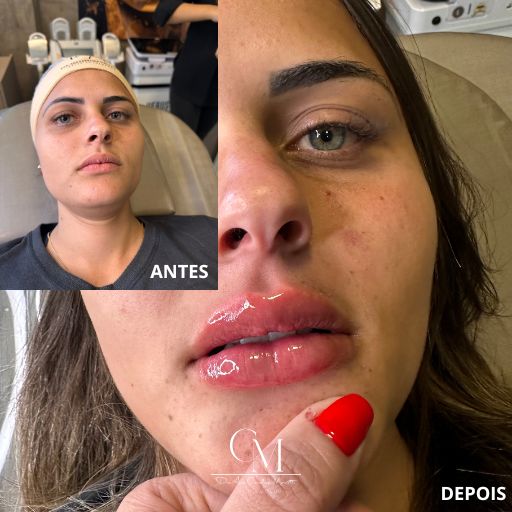 Labios-3