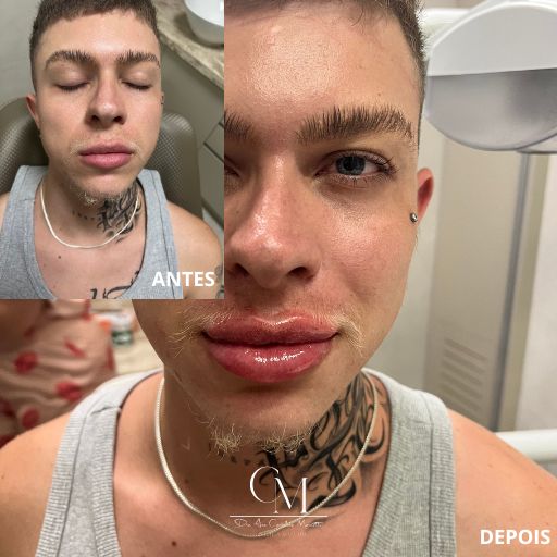 Labios-4