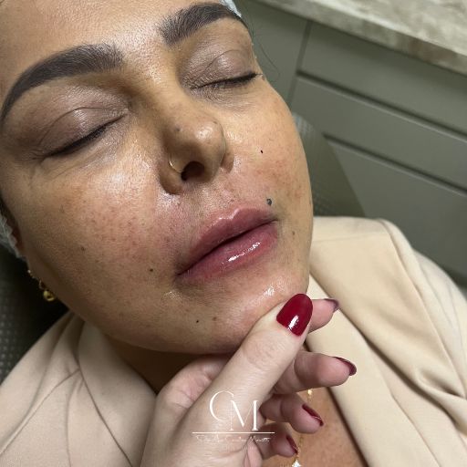 Labios-6